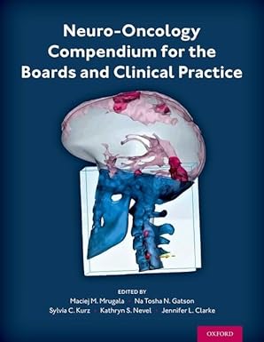 eBook For Neuro Oncology Compendium for the Boards and Clinical Practice 1st Edition By Maciej Mrugala