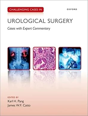 eBook For Challenging Cases in Urological Surgery 1st Edition By Karl Pang