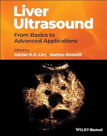 eBook For Liver Ultrasound From Basics to Advanced Applications 1st Edition By Adrian K. P. Lim