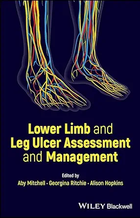 eBook For Lower Limb and Leg Ulcer Assessment and Management 1st Edition